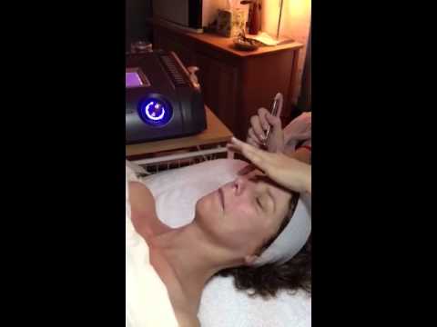 Diamond tip Microdermabrasion