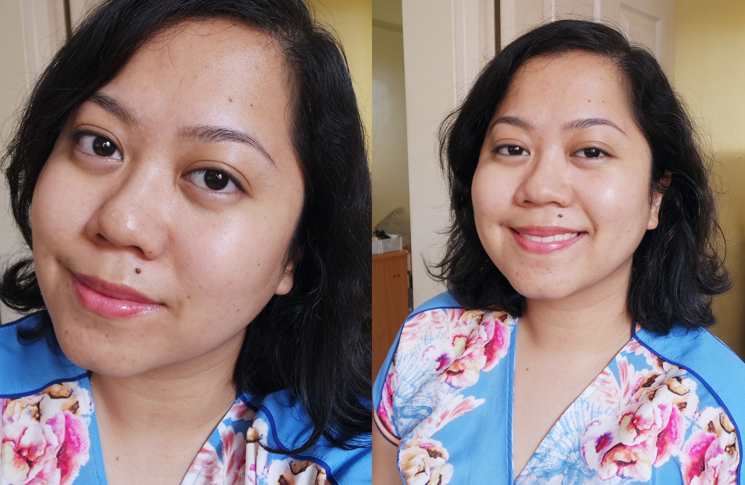  Reader Question: How I transformed my ugly skin