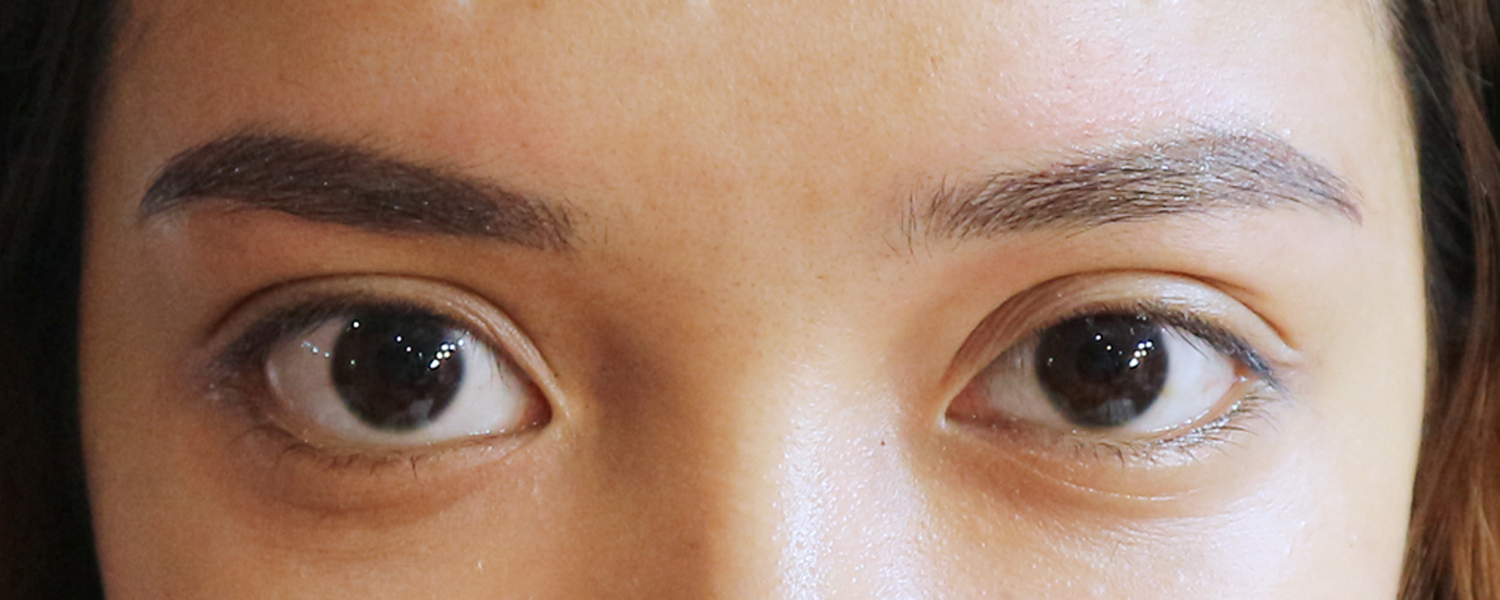 My brows immediately after the procedure