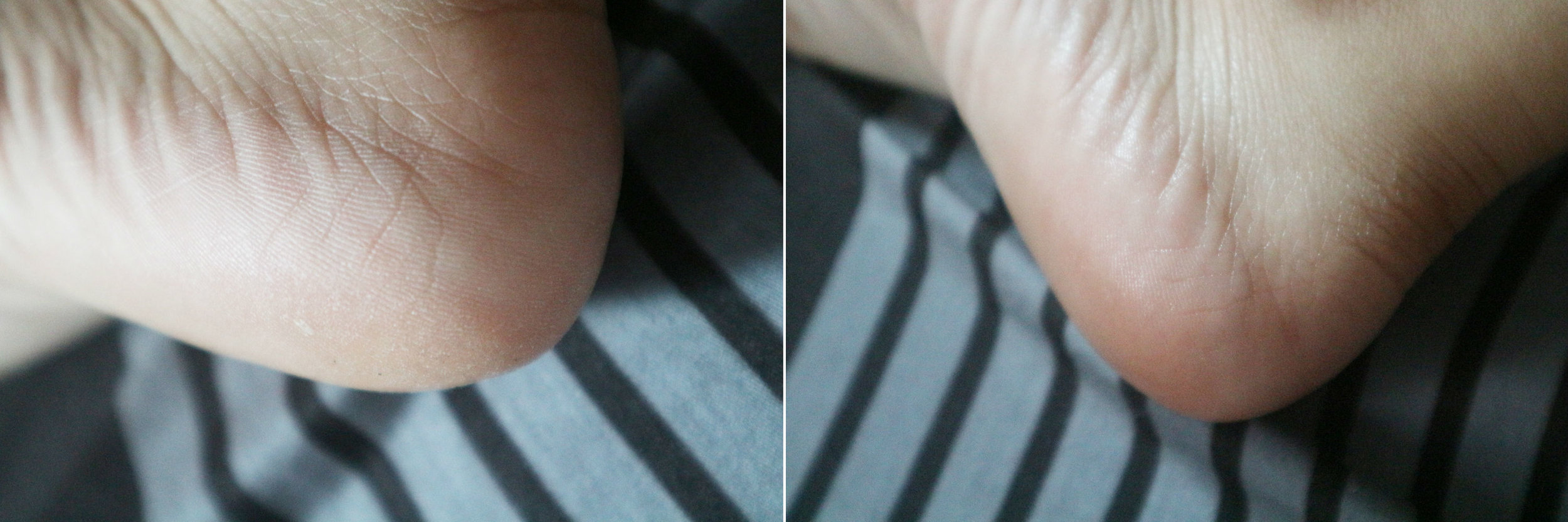 Before and after application