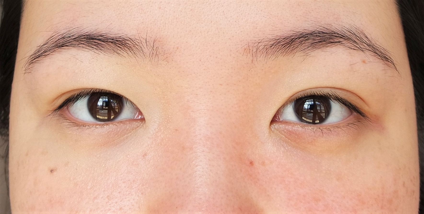 On your left: Wearing a sheer layer of the 2-in-1 Eye Bag Miracle Kit; on your right: bare skin