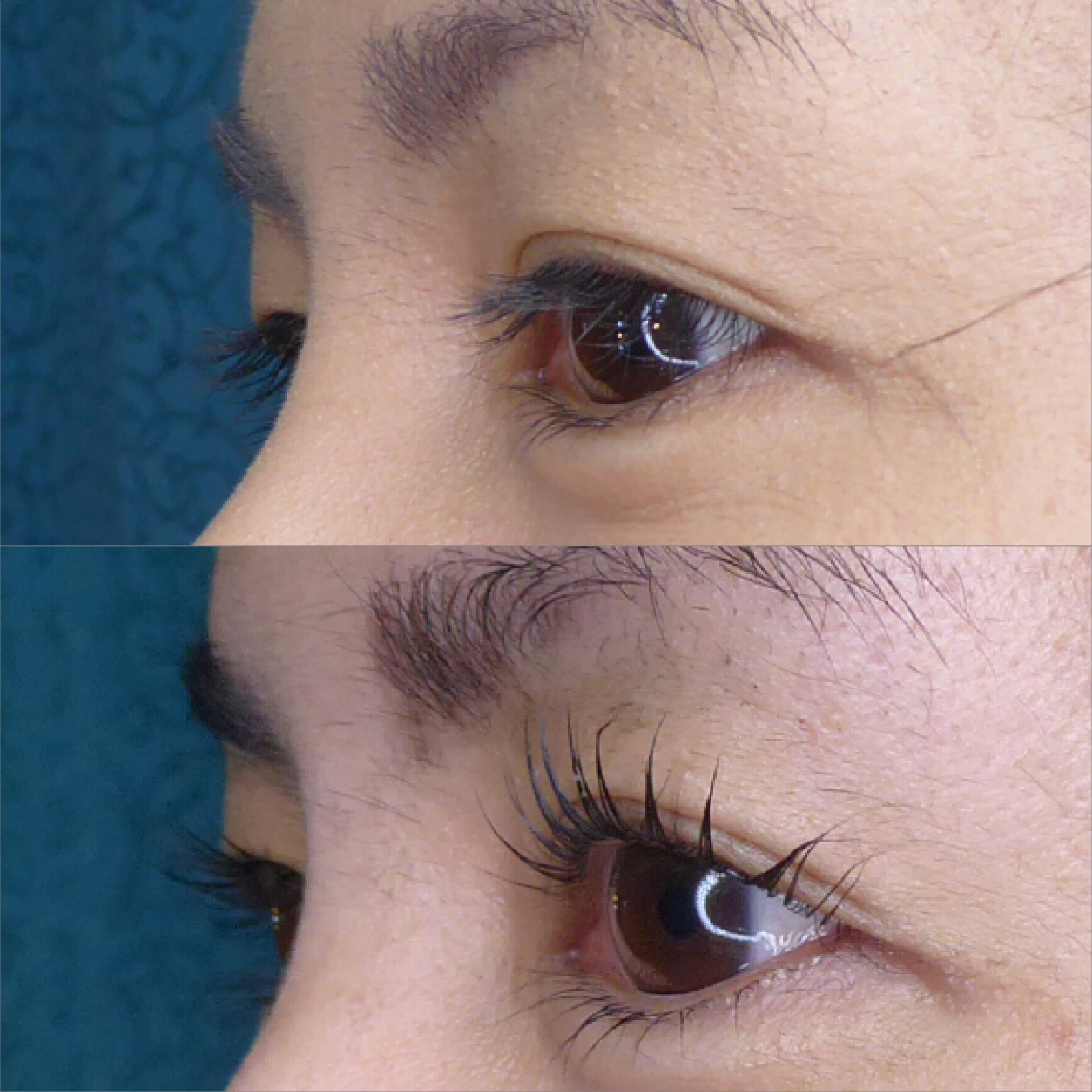 Before and after