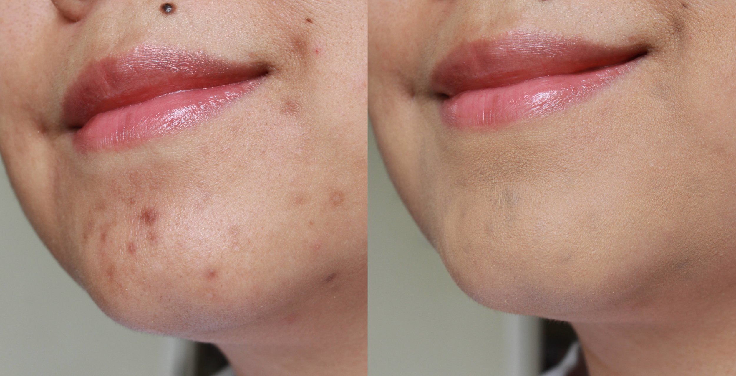 Ellana Mineral Concealer and Foundation in Smile