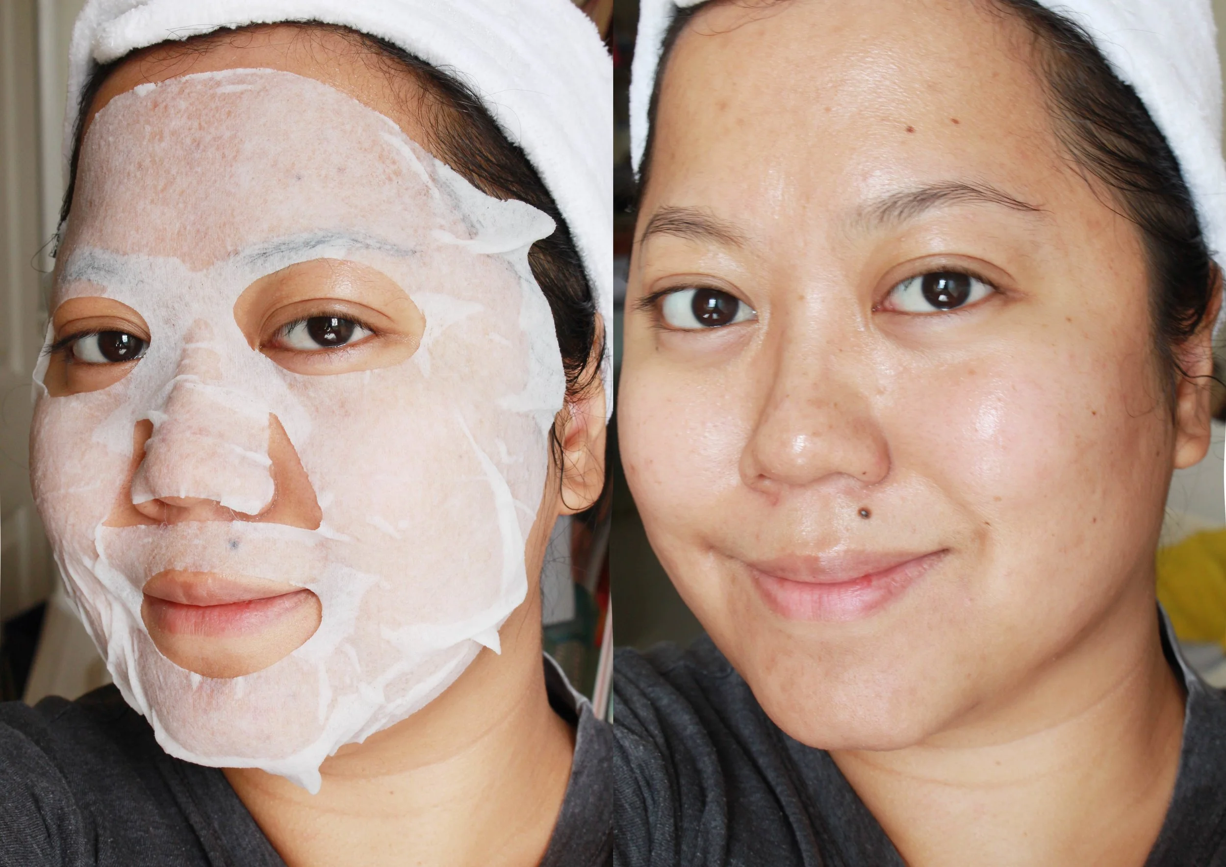 Love my skin here