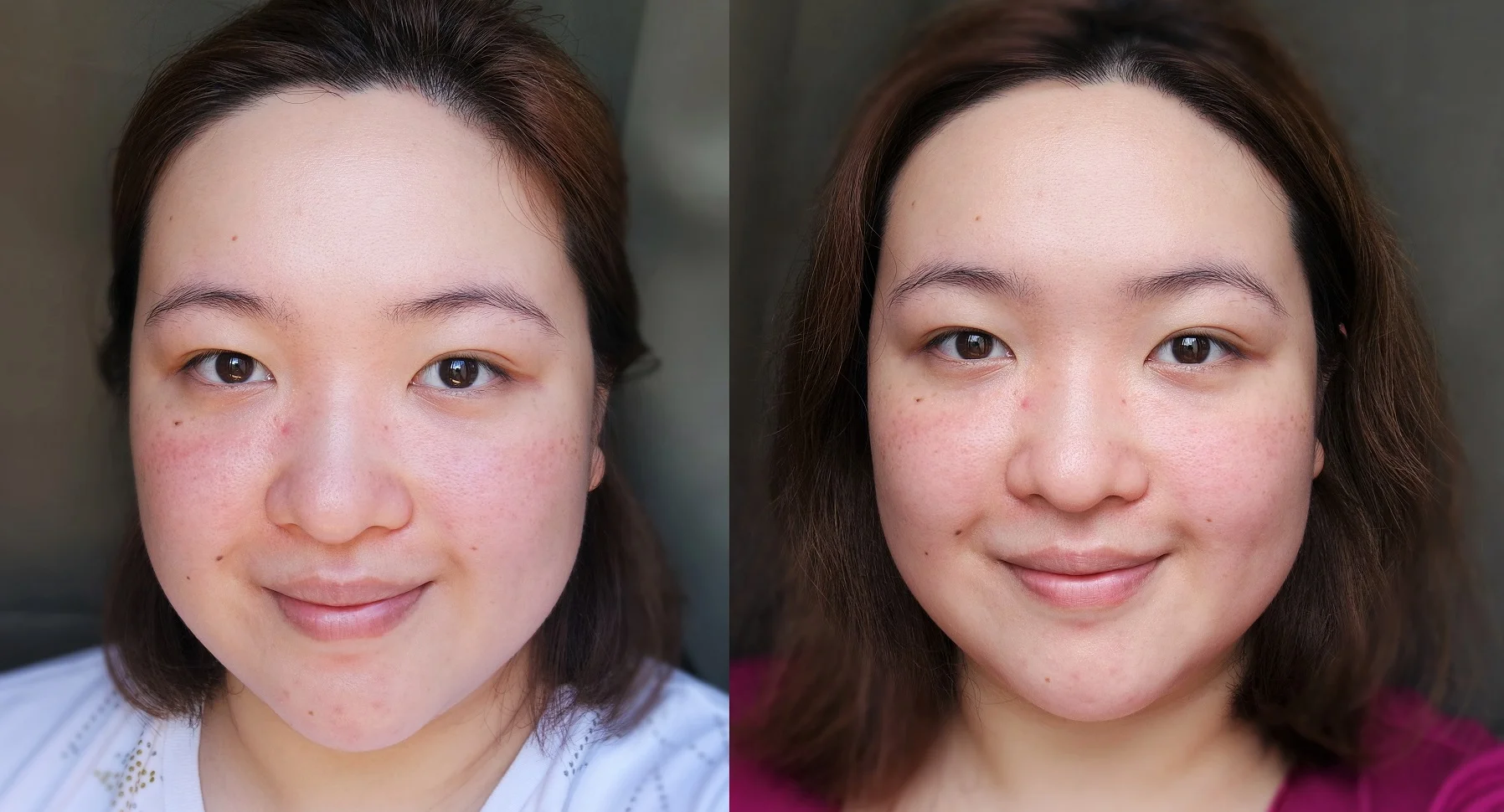 Before and after