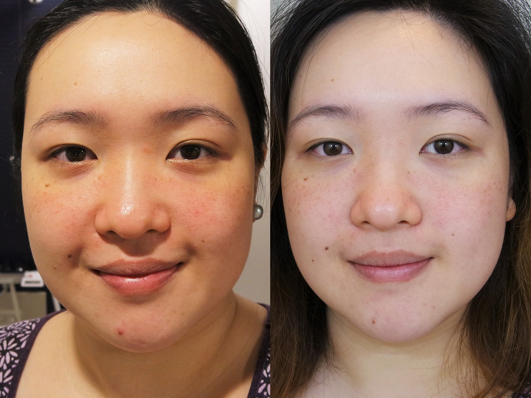Before the masking trial and after Day 4 of masking