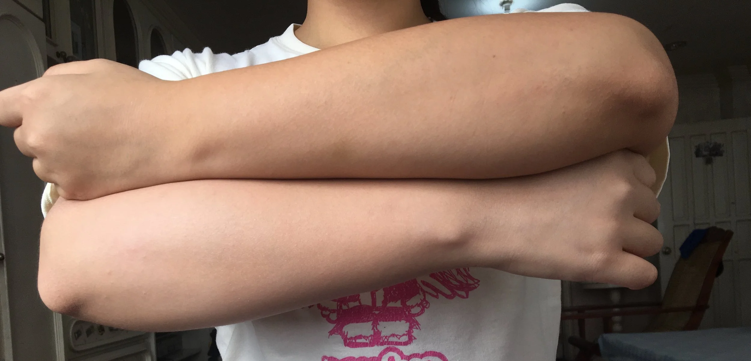 The arm on top shows my commuter tan, while I applied the Shiroashi Hime to the arm below!