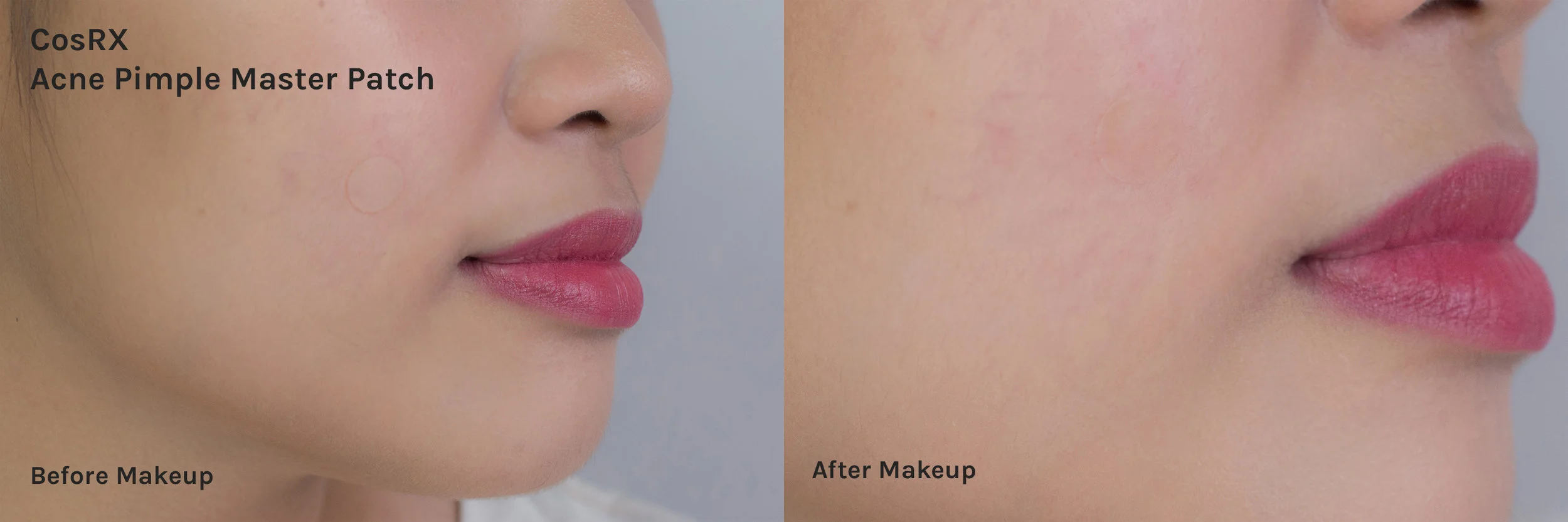 Can you really wear acne patches under makeup? We test six types to find out the best! — Project