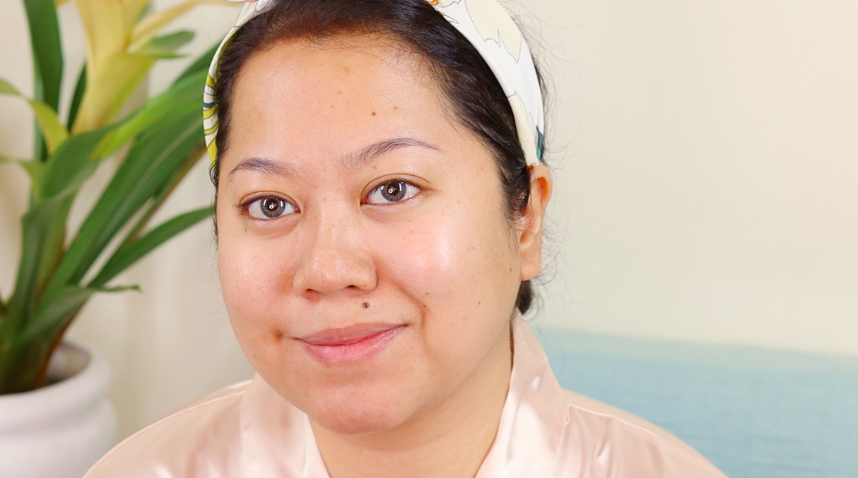 My skin today. I’m 31 and wiser!