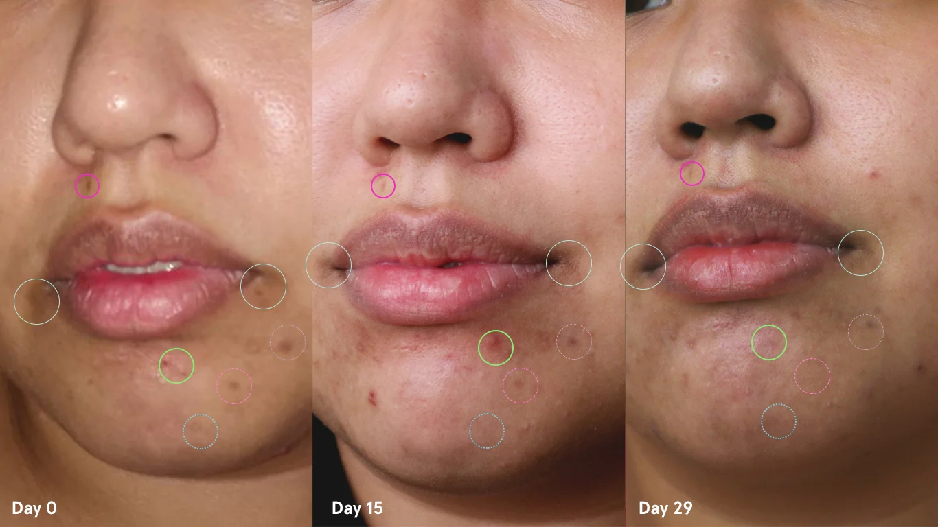 1910-Kiehls-LUCYS-5-Before-After.jpg