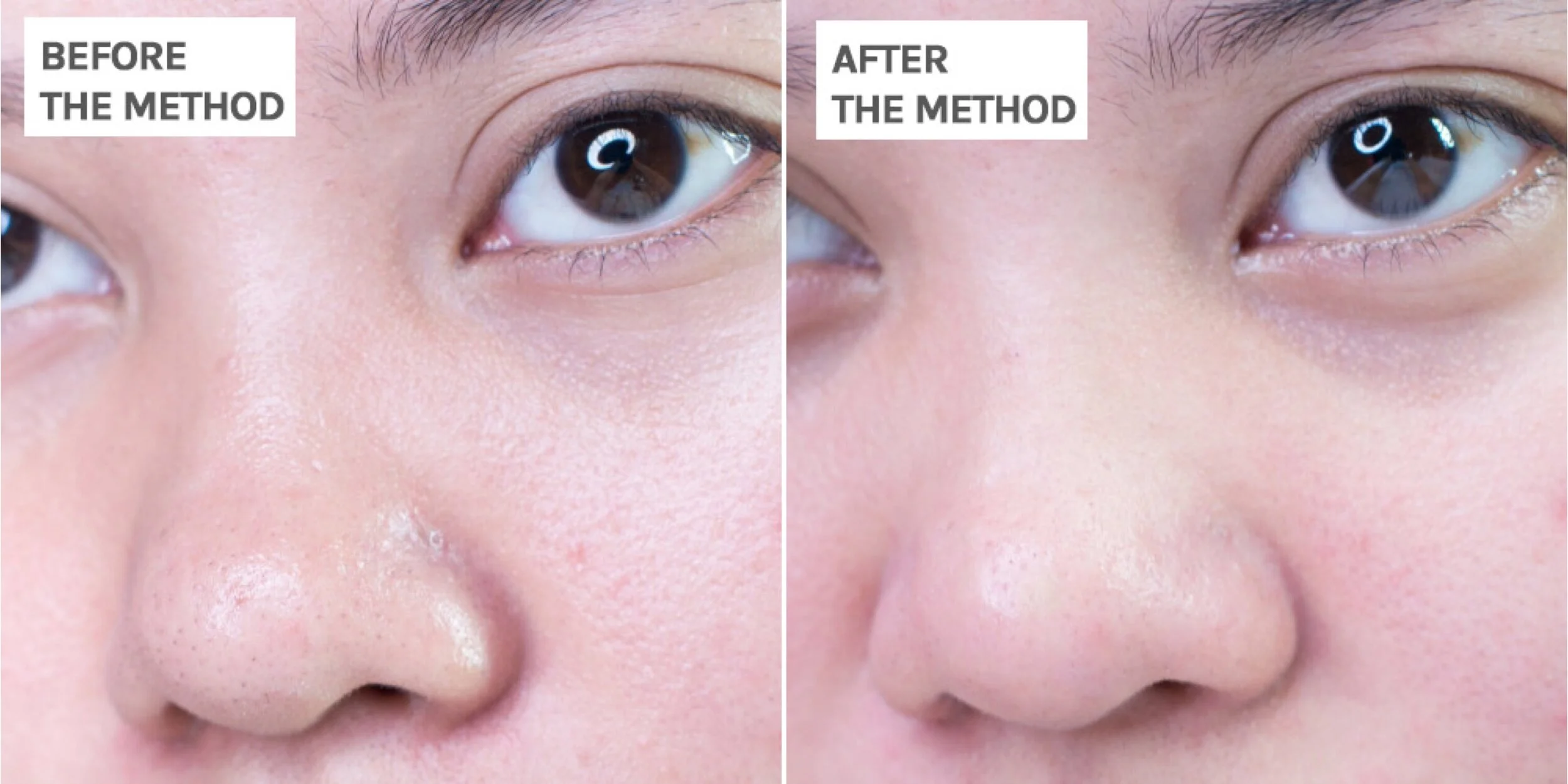 oil cleansing sebaceous filaments