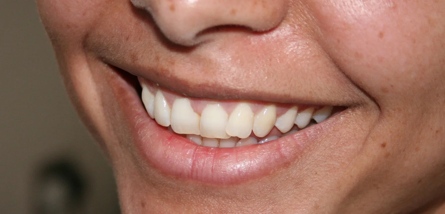 22389.jpg