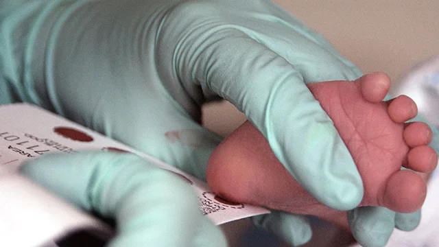 Phenylketonuria_testing.jpg