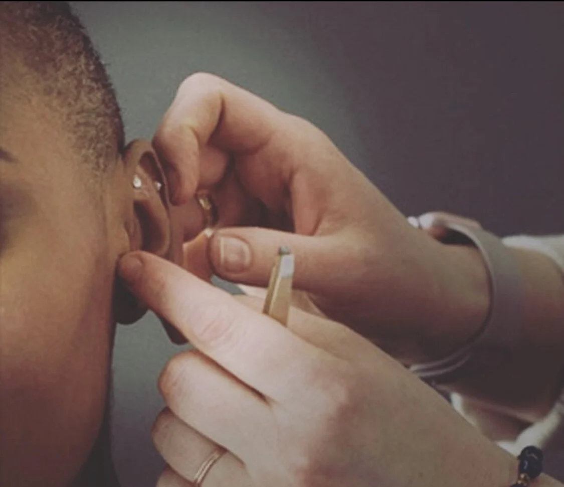 Ear Seeds: Do They Really Work?