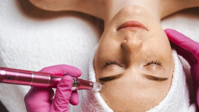 A Look at Microneedling Before and After