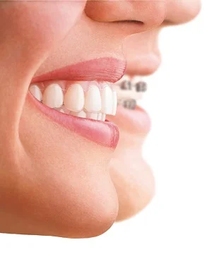 invisalign2images.jpg