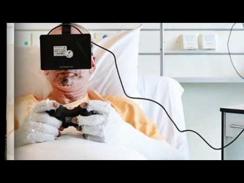 VR-therapy is used to treat burn victims in order to help alleviate pain