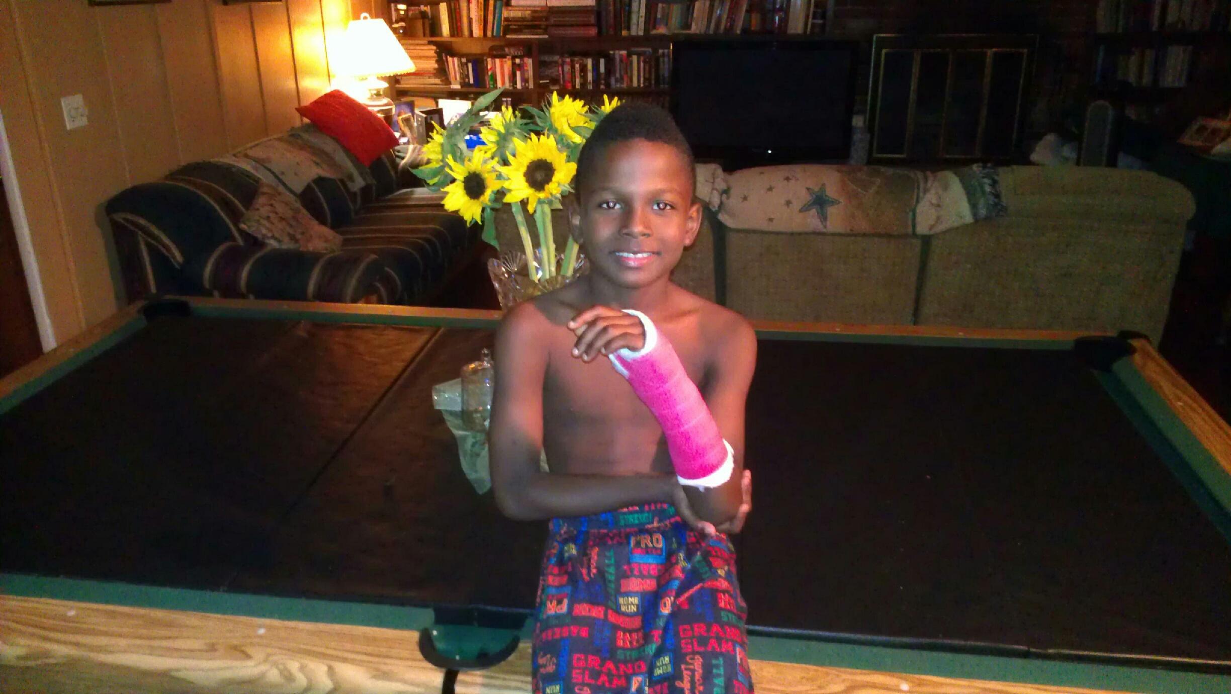Kalonji, age 8 in his red cast posing in his grandparents' living-room in Randallstown, Maryland