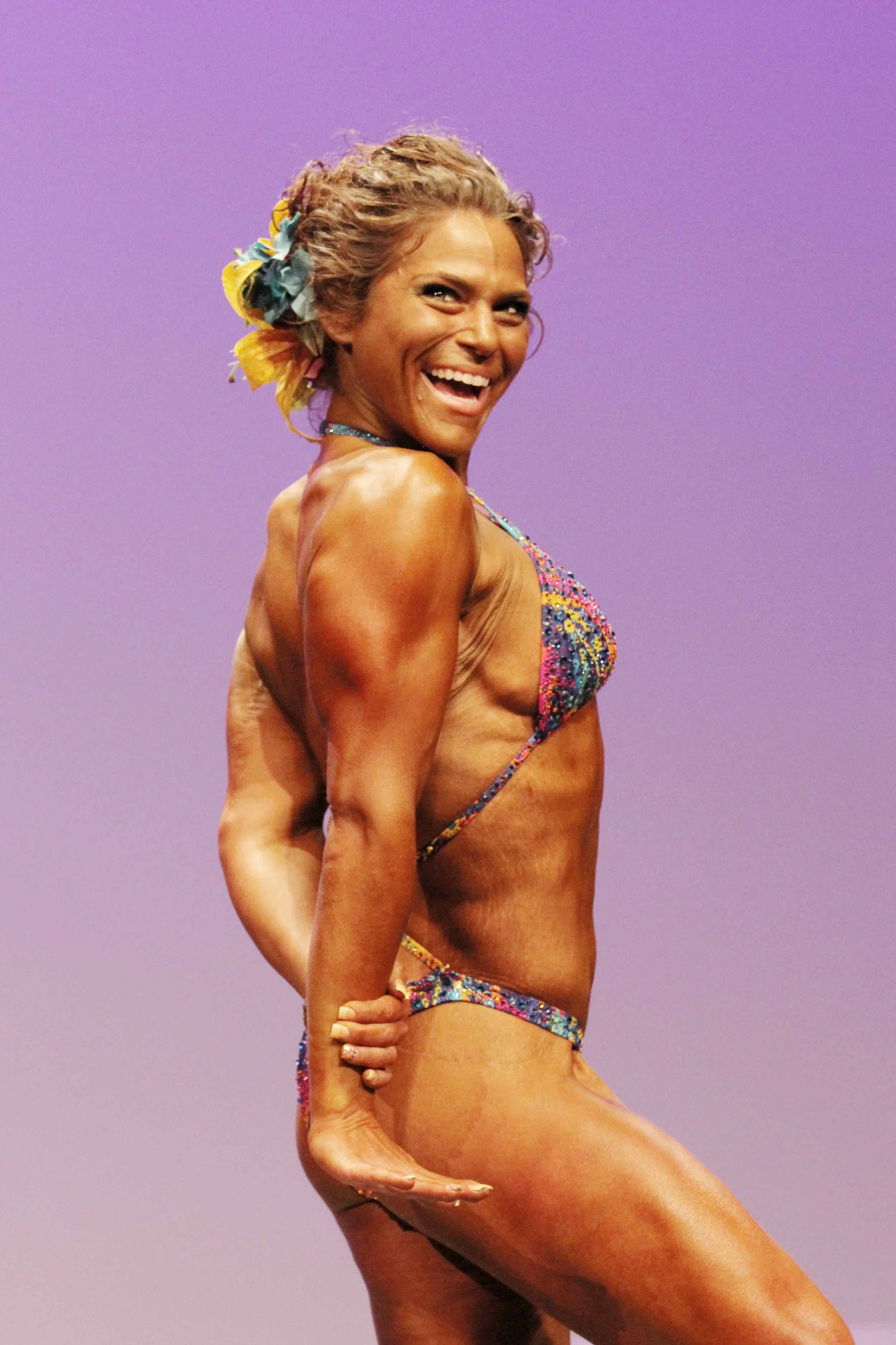 Transformation Success Story: From Bariatric Surgery to Bodybuilding