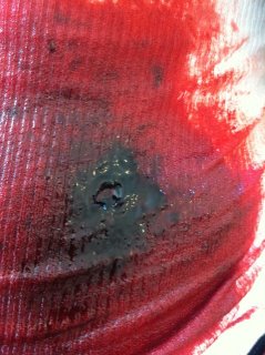 Gun shot wound