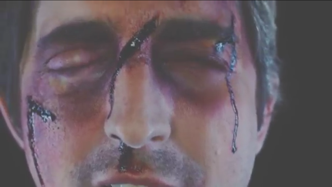 Screen shot from "Fight for You" music video. Swollen eye prosthetic, bruising, cuts.