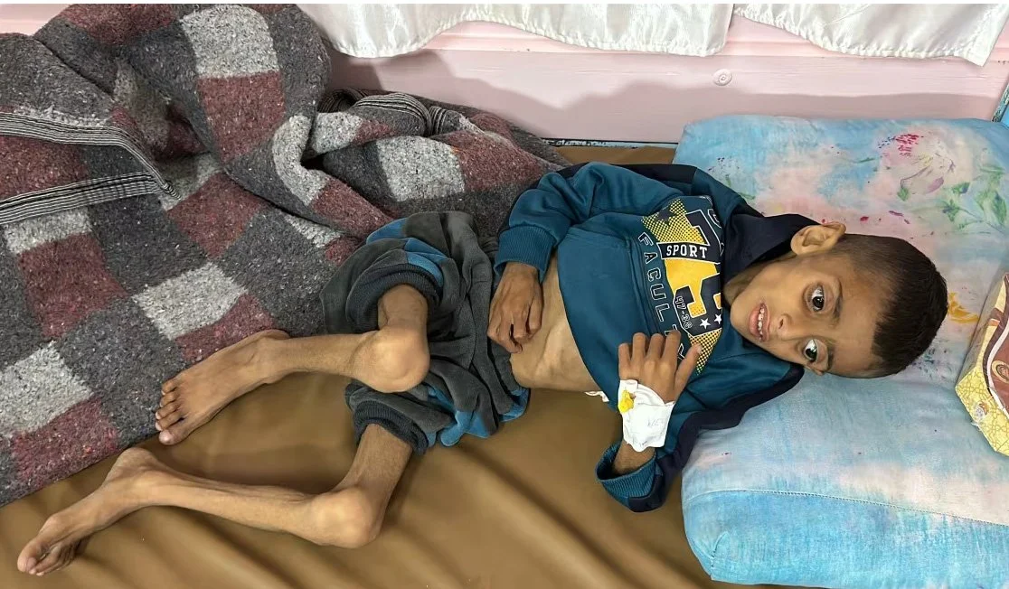 Starving Child in Gaza.jpg