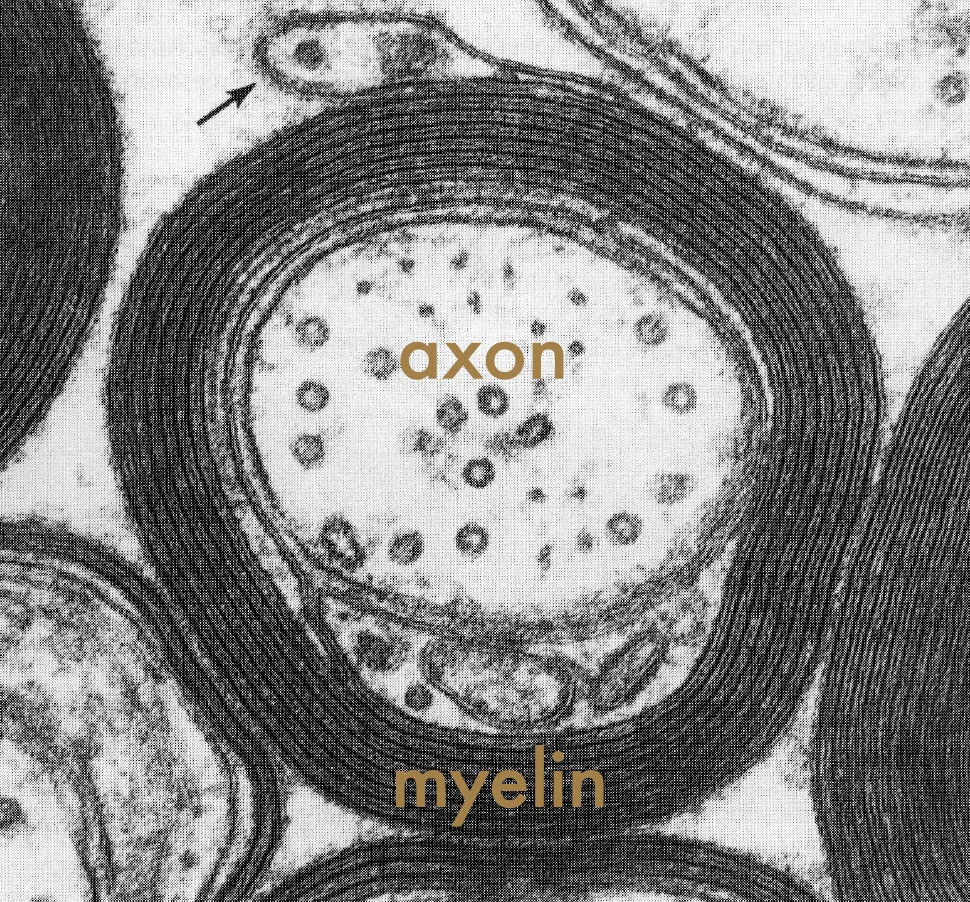 AxonMyelin.jpg