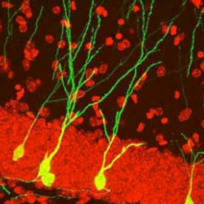 Neurogenesis.jpg