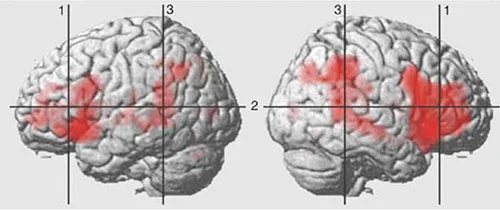 3-MRI-increasedblood.jpg
