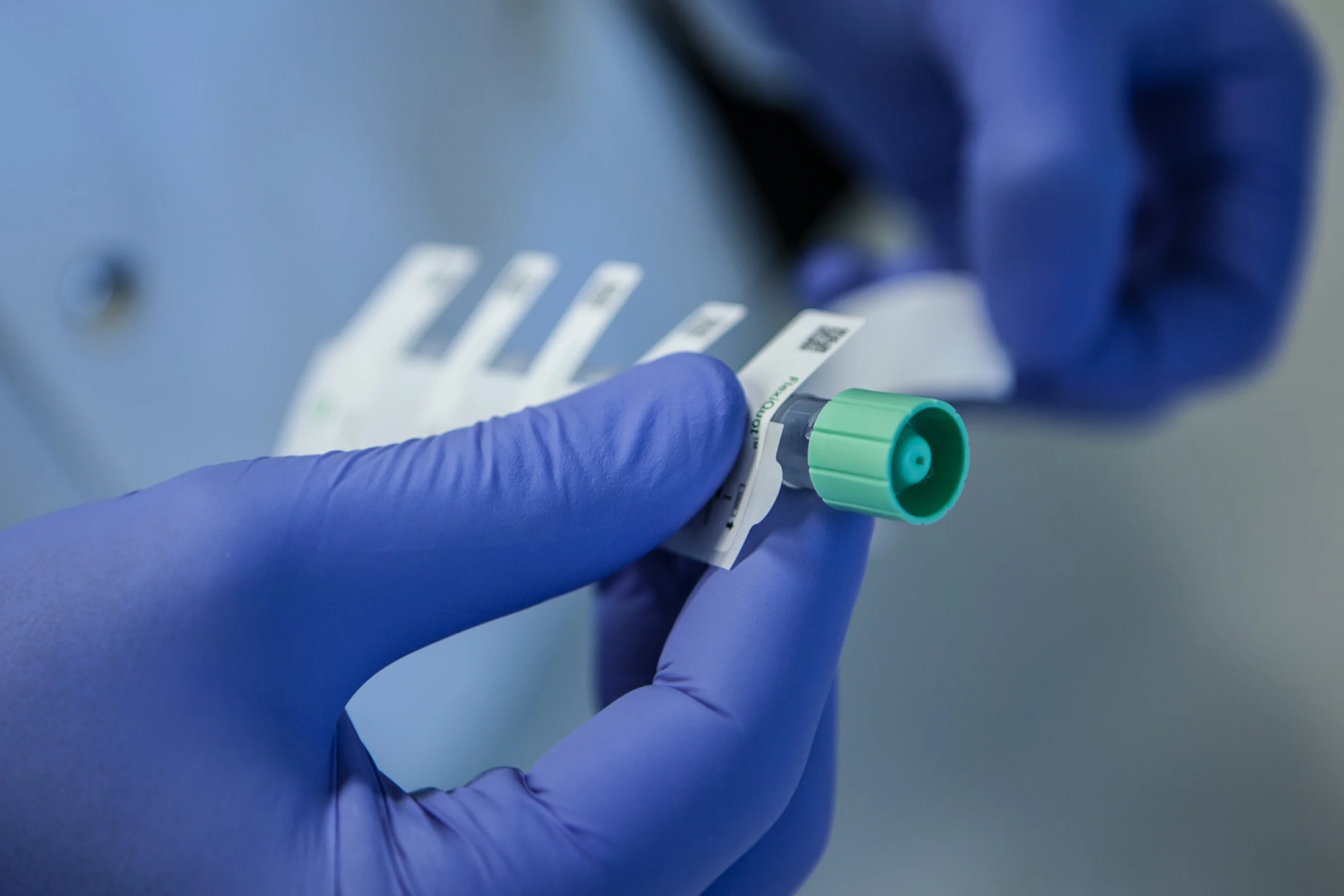 kfd-cryobio-web6.jpg