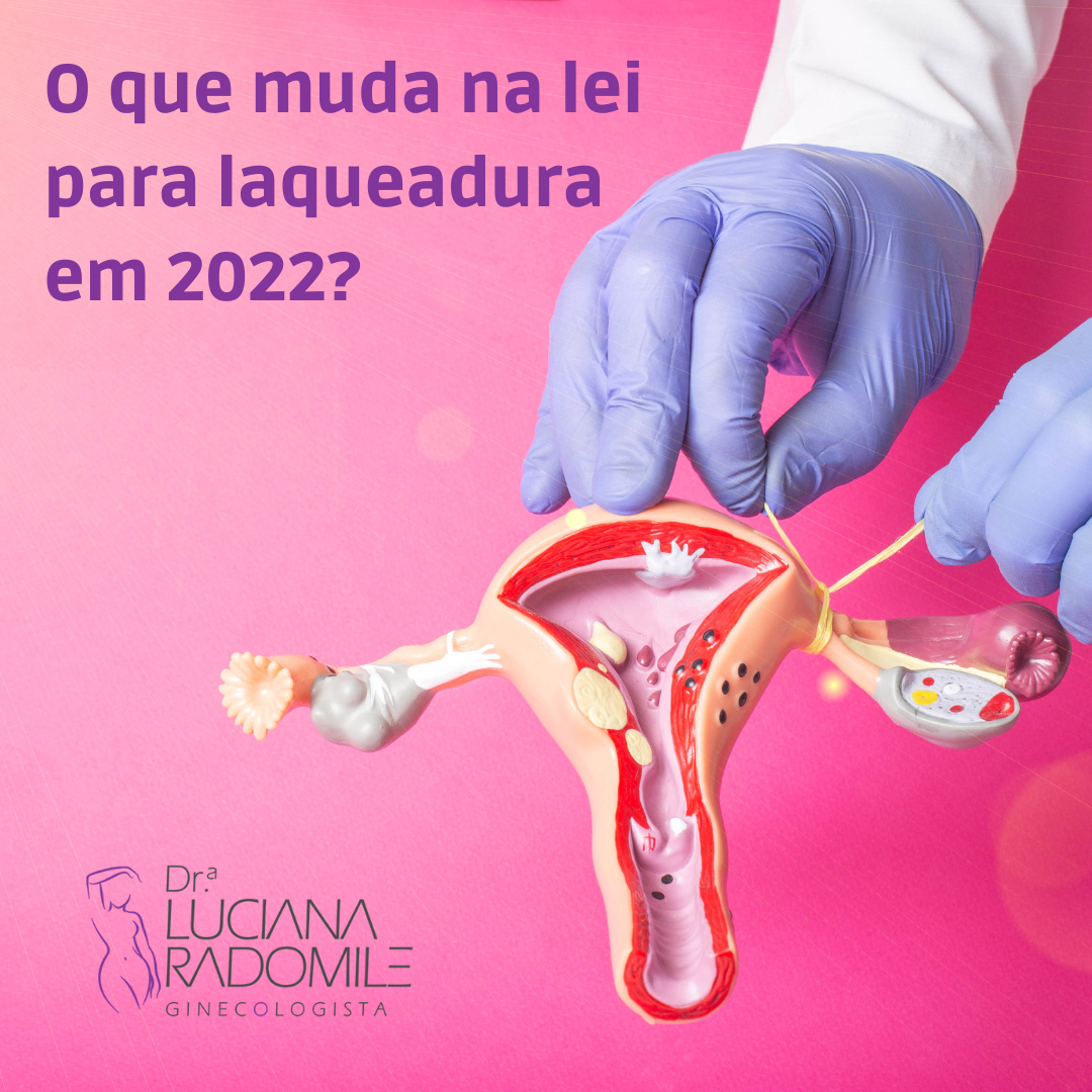 O que muda na lei para laqueadura? - Coluna Ginecologia e Obstetrícia ...