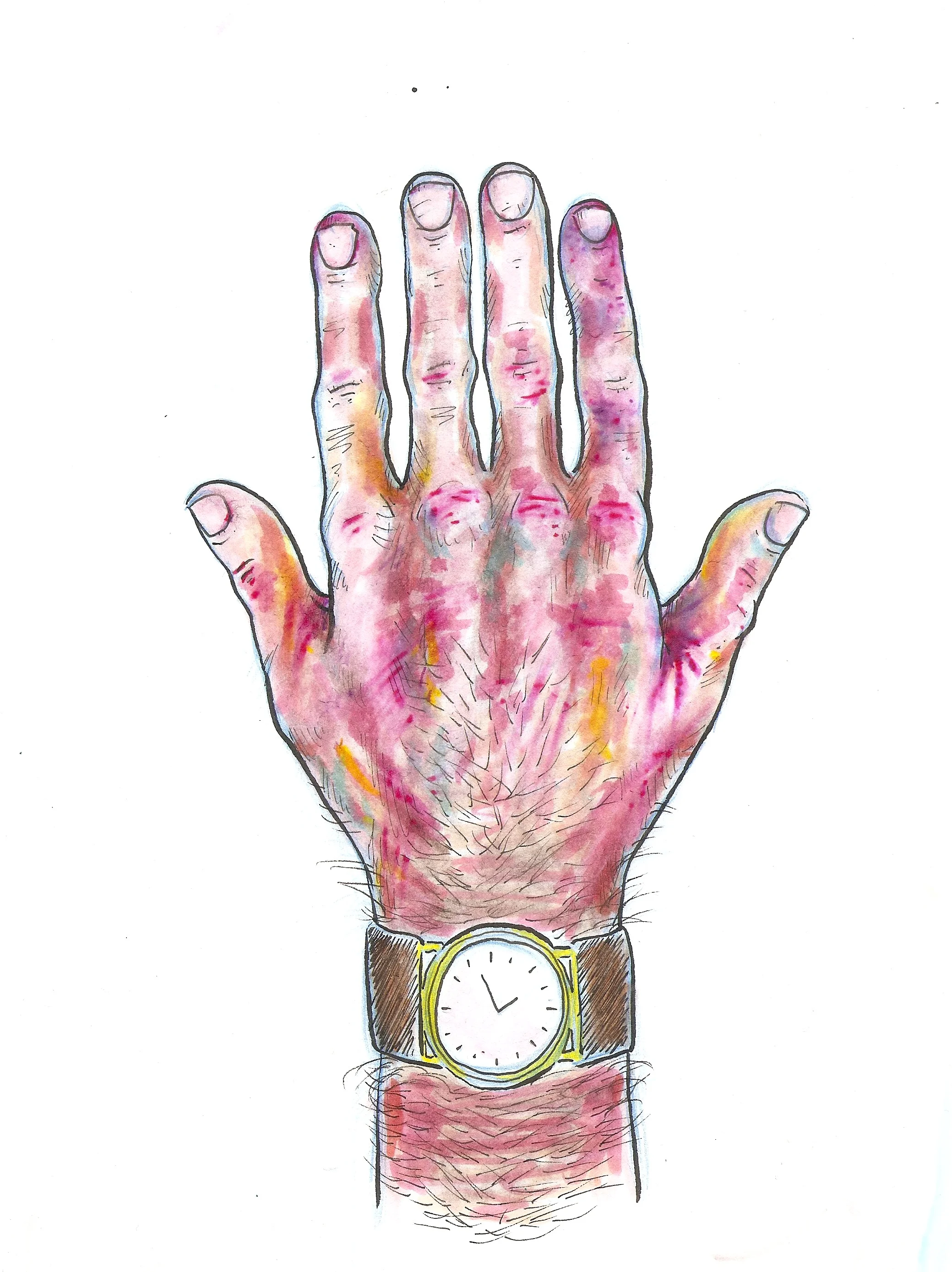 The Man Of Adventure Pays The Price For His Derring-Do