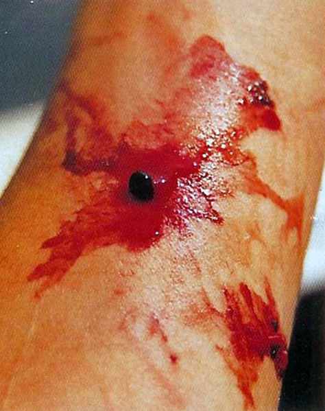 Abbildung 7. Das gerinnungshemmende Hirudin bewirkt, daß Blut aus der winzigen Bißstelle nachsickert.
