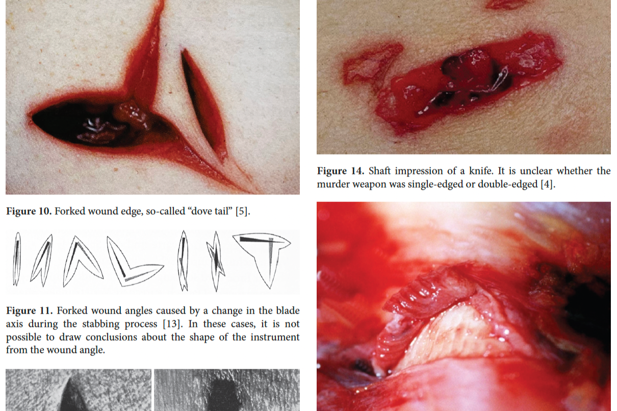 Clues of violence in human tissue: death of a homeless man