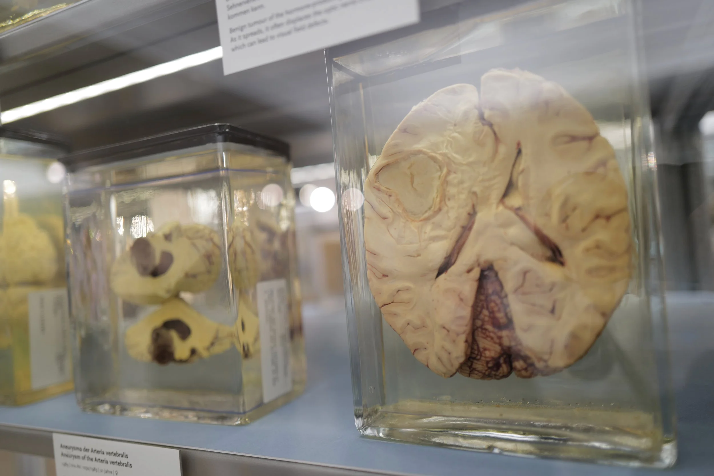 mark_benecke_charite_medizinhistorisches_museum_berlin_schleim_ausstellung - 9.jpeg