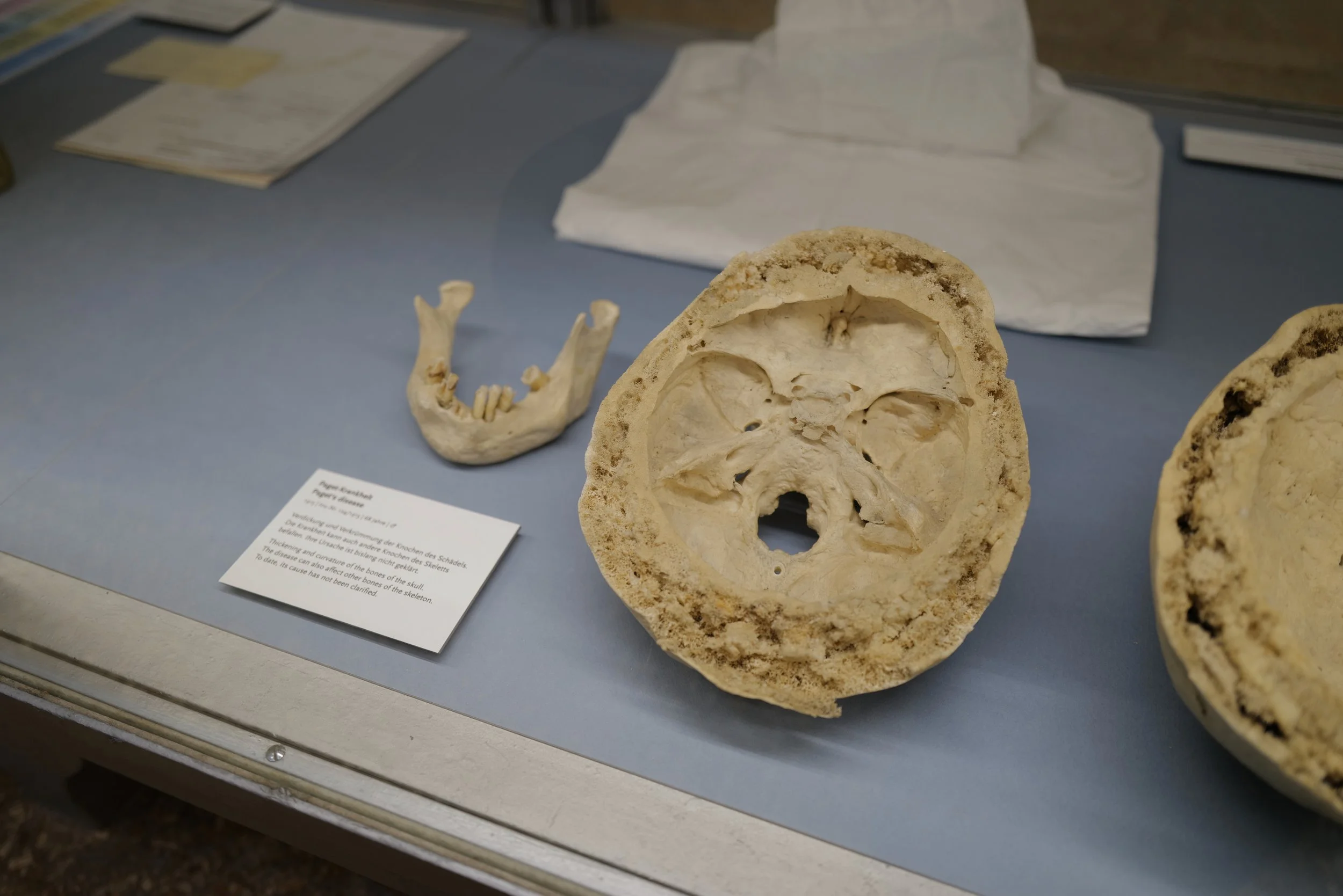 mark_benecke_charite_medizinhistorisches_museum_berlin_schleim_ausstellung - 11.jpeg