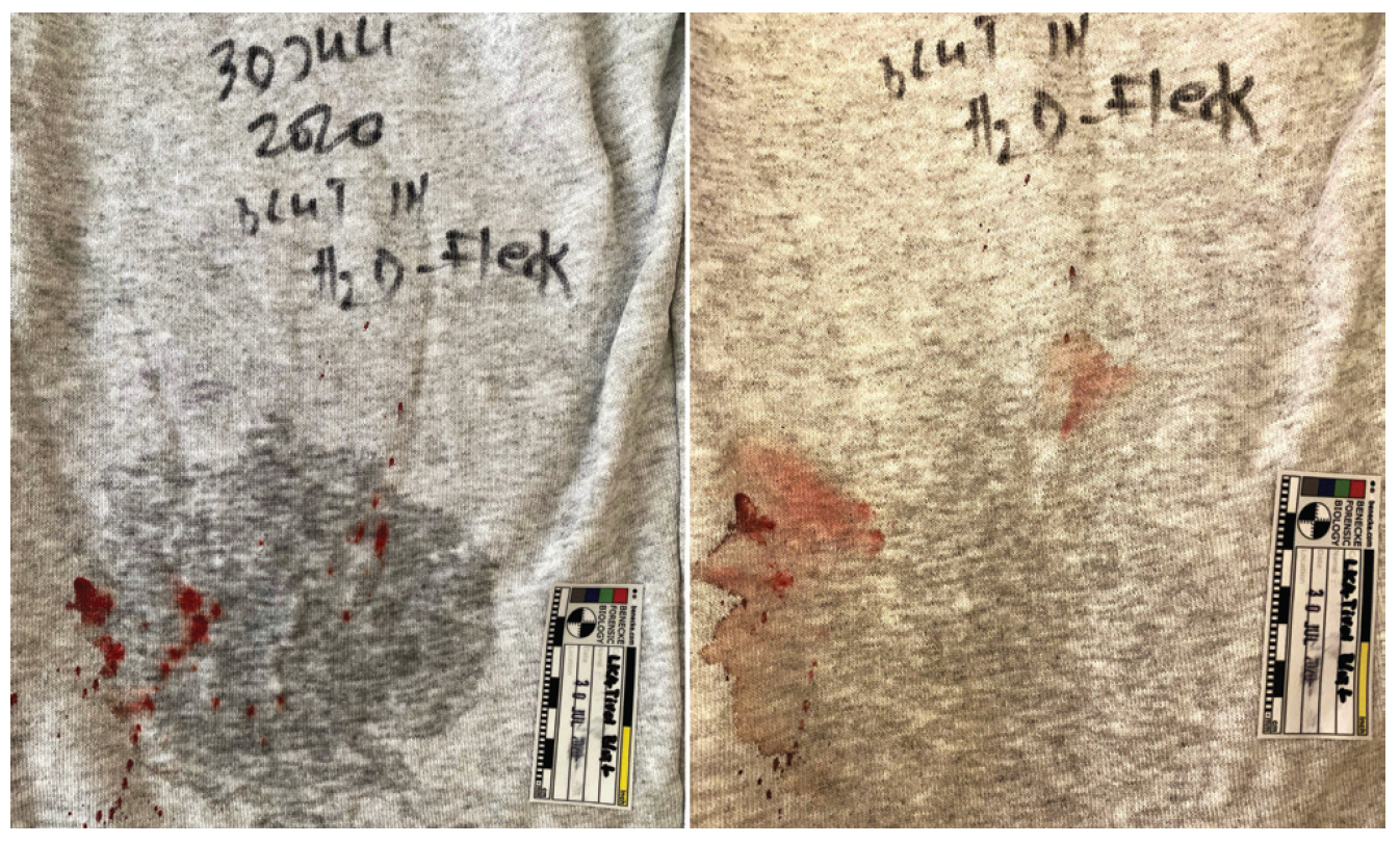 Experimental verification of statements using bloodstain