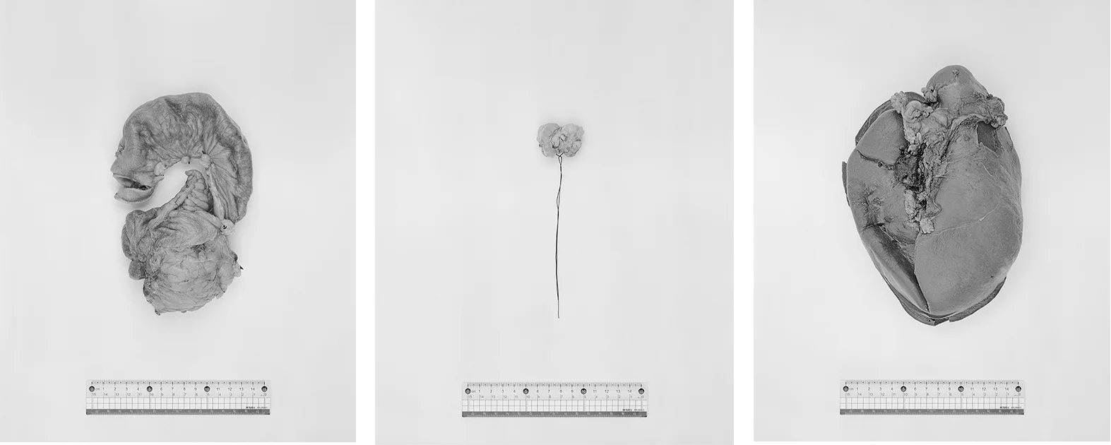 Li Zhaohui-Specimen:Human Organs under a ruler-photography-of-china.jpg