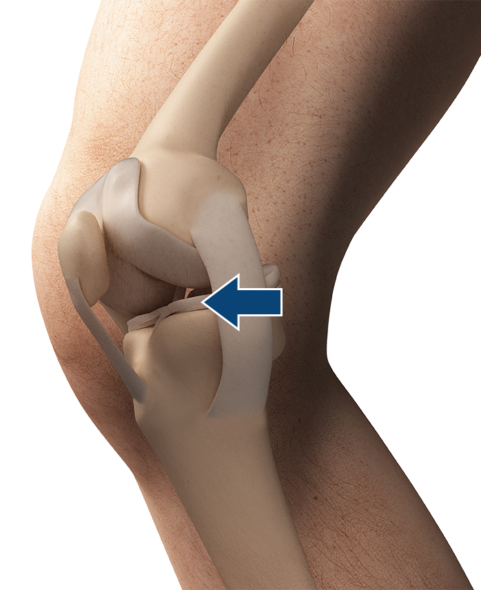 meniscus.png