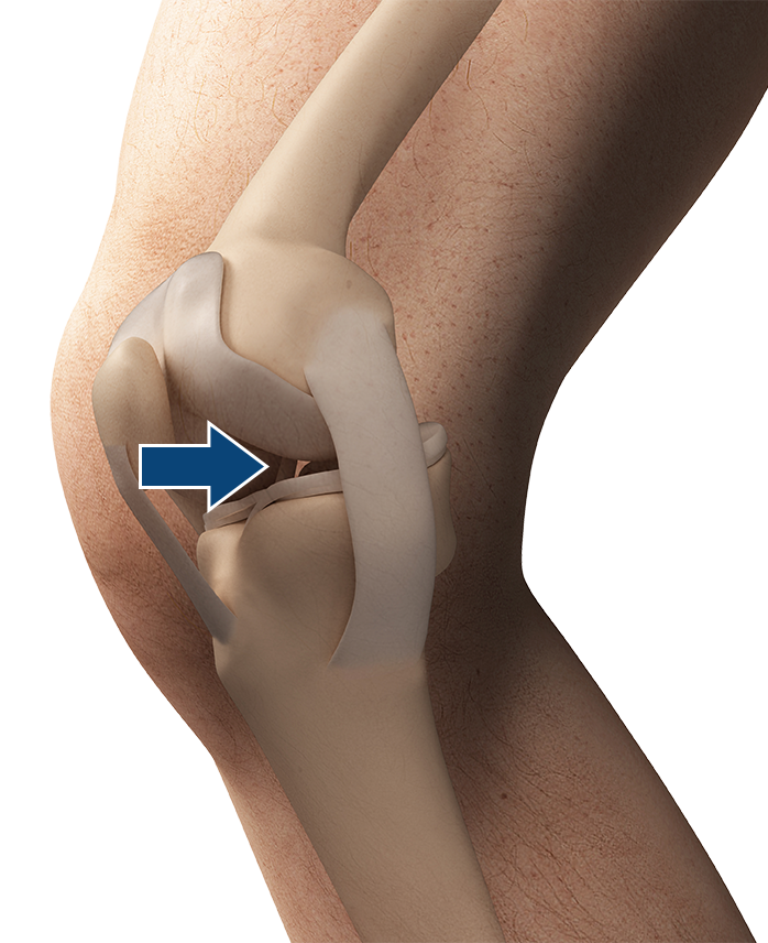 ligament.png