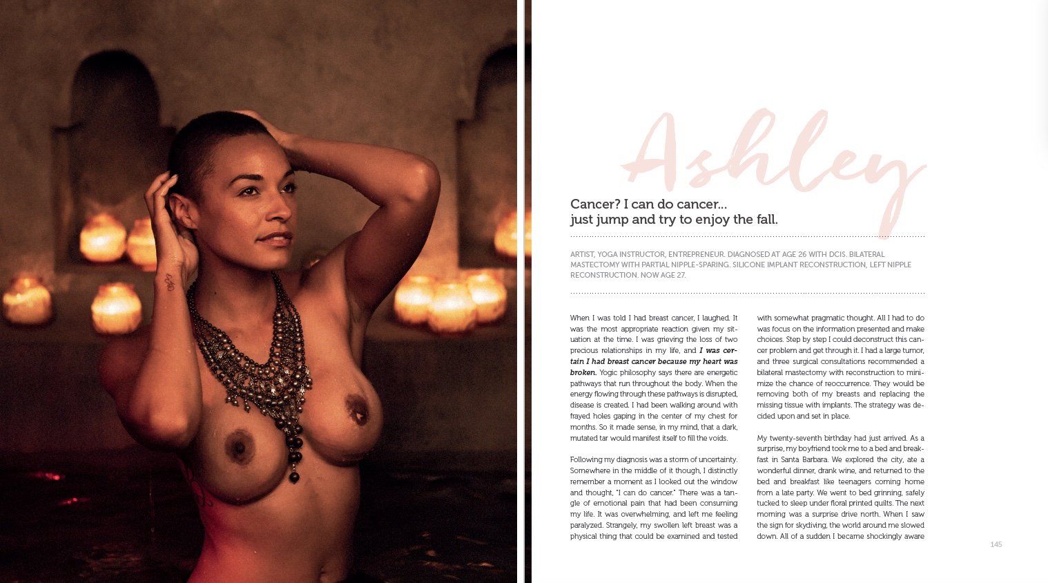 African American Young Woman with Bilateral Mastectomy and Nipple Sparing Silicone Implant Reconstruction Beautiful.jpg