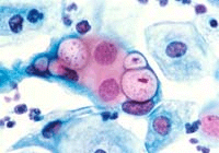 Chlamydia under a microscope