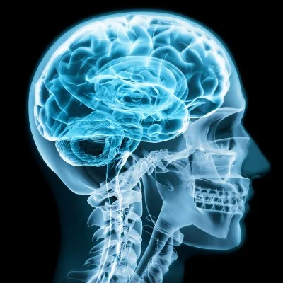 X-ray scan of the human brain
