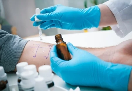 skin-prick-allergy-test.jpg