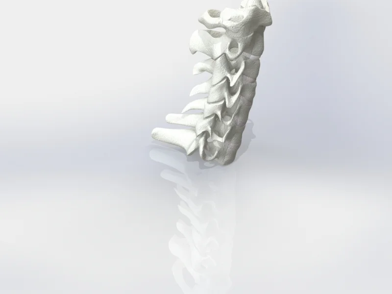 cervical.JPG