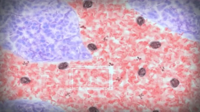 Scott E. Moore Medical Reel