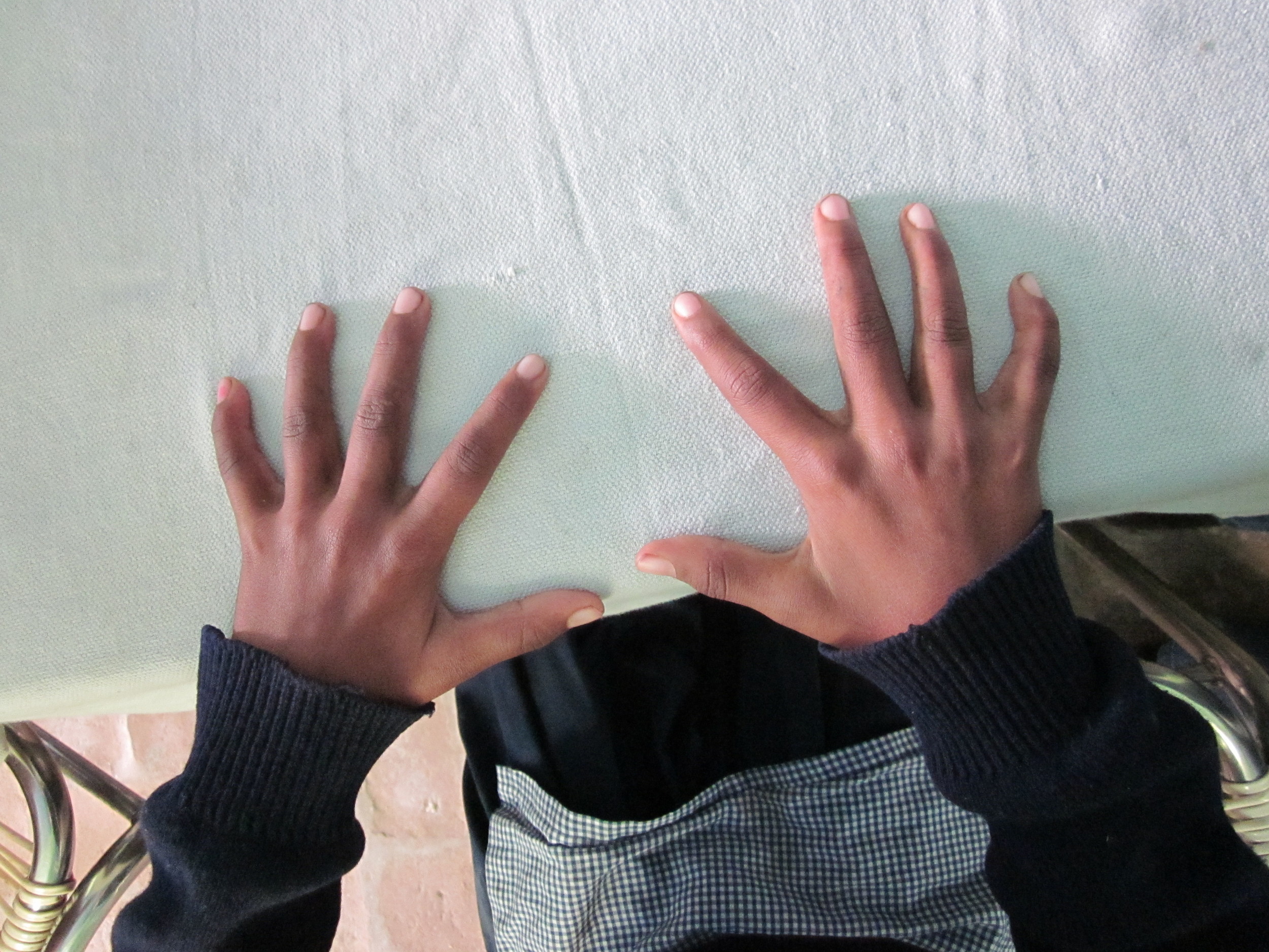 Juvenile rheumatoid.JPG