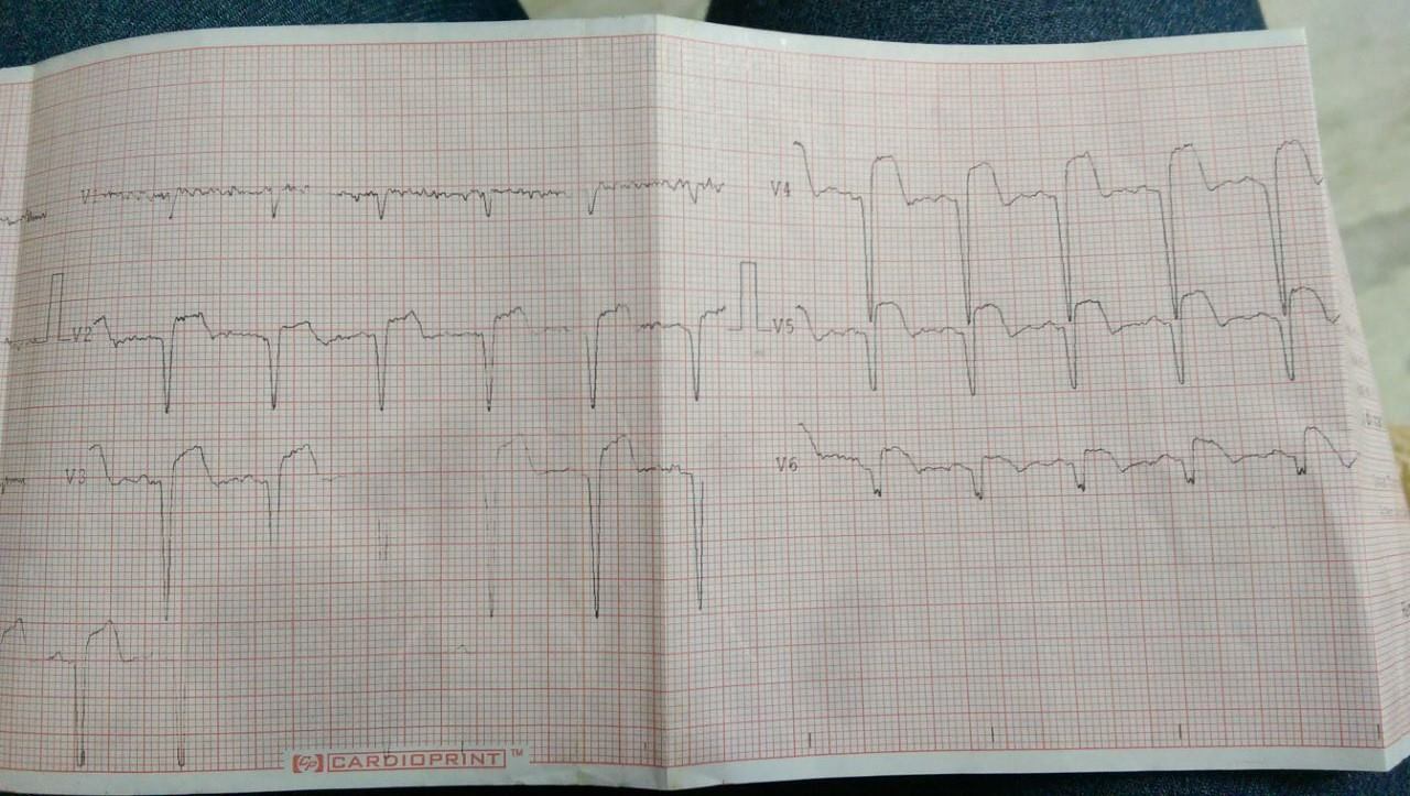 ekg.jpg