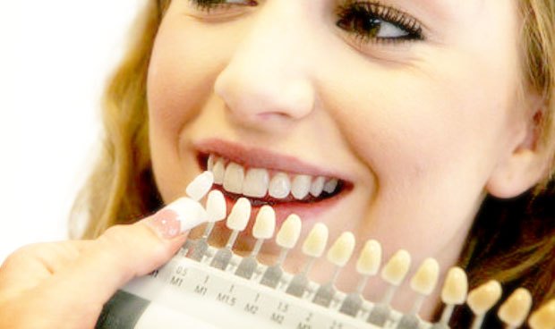 yellow-teeth-treatment.jpg