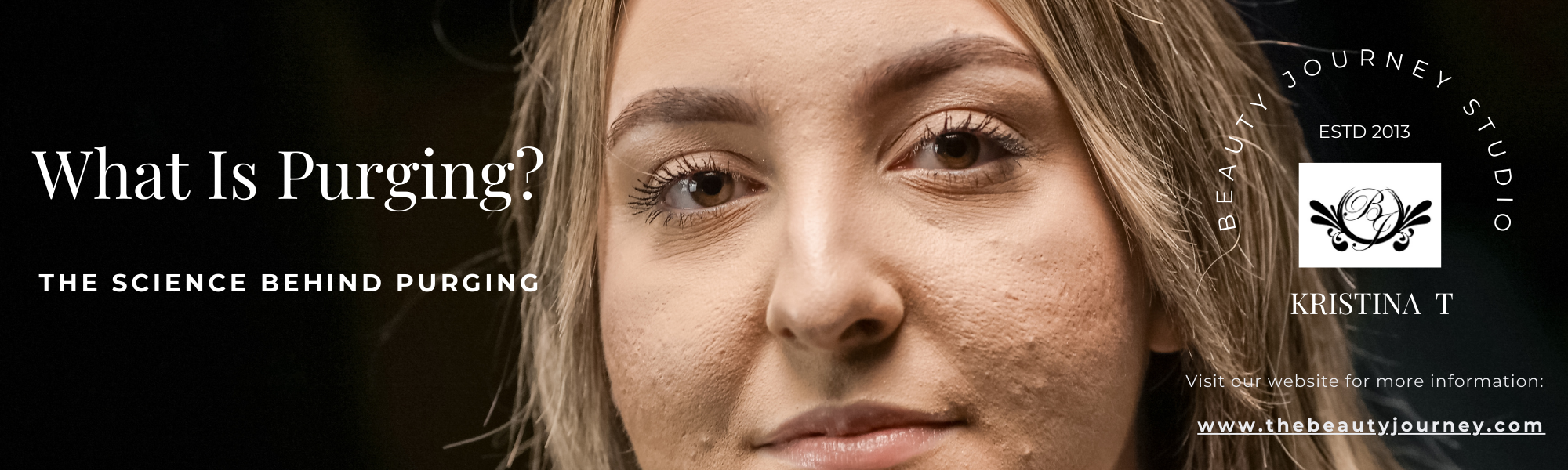 Why Your Skin Breaks Out After a Facial—The Truth About Purging vs. Bad Reactions